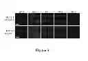 Fig. 06 - Soluble polypeptides