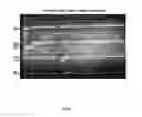 Fig. 02 - Method of treating inflammation using human immunosuppressive protein