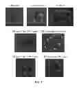 Fig. 08 - Method for treating intestinal fibrosis