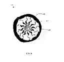Fig. 07 - Super paramagnetic iron oxide nanoparticles with metallic coatings and a method of synthesizing the same