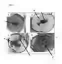 Fig. 02 - Diagnostic method and treatment