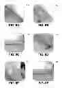 Fig. 09 - Peelable Coating
