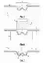 Fig. 02 - Method of making assemblies including reinforced composite parts with pre-formed rivet receiving buttons and articles made by the method