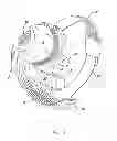 Fig. 02 - Flexible circuit electrode array and a method for backside processing of a flexible circuit electrode device