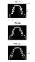 Fig. 06 - Method for periodontal disease measurement