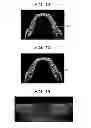 Fig. 07 - Method for periodontal disease measurement