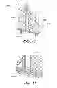 Fig. 72 - Apparatus for measuring analytes including chemical sensor array
