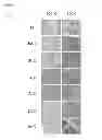 Fig. 08 - CANCER BIOMARKER AND METHODS OF USE THEREOF