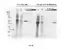 Fig. 28 - Methods for detection of botulinum neurotoxin