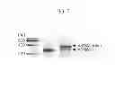 Fig. 08 - NUCLEIC ACID LINKER