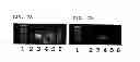 Fig. 08 - Methods for treating neural cell swelling