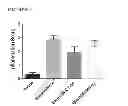 Fig. 08 - Method for treatment of pulmonary fibrosis