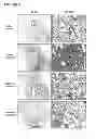 Fig. 10 - Method for treatment of pulmonary fibrosis