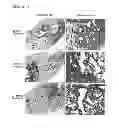 Fig. 16 - Method for treatment of pulmonary fibrosis