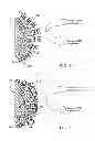 Fig. 02 - Polyelectrolyte-Coated Ion-Exchange Particles