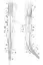 Fig. 09 - CATHETER INCLUDING A BENDABLE PORTION