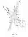 Fig. 09 - Surgical access system and related methods