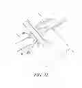 Fig. 22 - Surgical access system and related methods