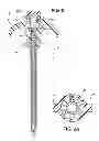 Fig. 03 - Veress needle with illuminated guidance and suturing capability