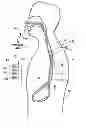 Fig. 01 - Device to block emesis and reflux and associated system and method