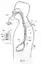 Fig. 02 - Device to block emesis and reflux and associated system and method