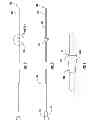 Fig. 03 - Device to block emesis and reflux and associated system and method