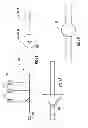 Fig. 08 - Device to block emesis and reflux and associated system and method