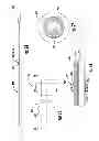 Fig. 11 - Device to block emesis and reflux and associated system and method