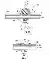 Fig. 18 - Device to block emesis and reflux and associated system and method