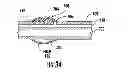 Fig. 19 - Device to block emesis and reflux and associated system and method