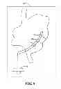 Fig. 07 - Method and determination of cardiac activation from electrograms with multiple deflections