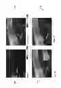 Fig. 05 - Methods and Systems for Imaging Tissue Motion Using Optical Coherence Tomography