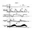 Fig. 08 - Ultrasound imaging equipment and method
