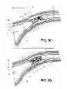 Fig. 04 - METHODS AND DEVICES FOR OCCLUDING AN OVARIAN PATHWAY