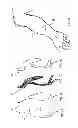 Fig. 07 - Device, system and method for blood vessel imaging and marking