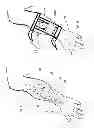 Fig. 09 - Device, system and method for blood vessel imaging and marking