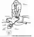 Fig. 01 - CPR quality assessment accounting for pause aspect