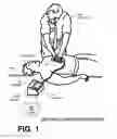 Fig. 02 - CPR quality assessment accounting for pause aspect