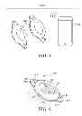 Fig. 02 - Methods and devices for treating hypertension