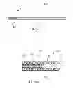 Fig. 09 - Adjustable glaucoma implant