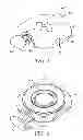 Fig. 02 - INTEGRATED MICRONEEDLE ARRAY DELIVERY SYSTEM