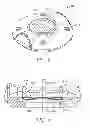 Fig. 08 - INTEGRATED MICRONEEDLE ARRAY DELIVERY SYSTEM
