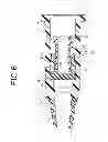 Fig. 07 - Indwelling catheter