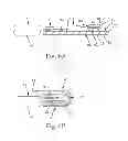 Fig. 06 - Fastening systems for use with absorbent articles