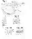 Fig. 02 - Gastric sizing systems including instruments for use in bariatric surgery