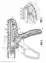 Fig. 04 - Surgical instrument with actuator spring arm