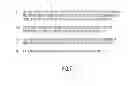Fig. 08 - Ablation catheter system with wireless radio frequency temperature sensor