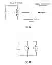Fig. 09 - Ablation catheter system with wireless radio frequency temperature sensor