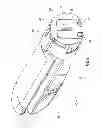 Fig. 12 - ELECTROSURGICAL DEVICE AND METHODS OF MANUFACTURE AND USE