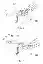 Fig. 08 - Bone plate structure, surgery device and method for bone plate implant